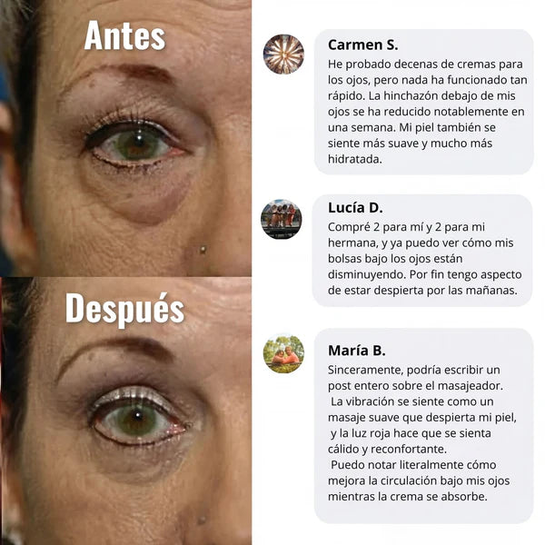 LumiEye System™ Kit LED con Crema Contorno Activa